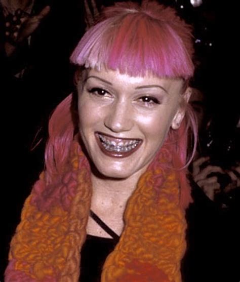 Gwen stefani, tom dumont, tony kanal, adrian young; braces | gwen stefani 90s | Celebrities with braces ...