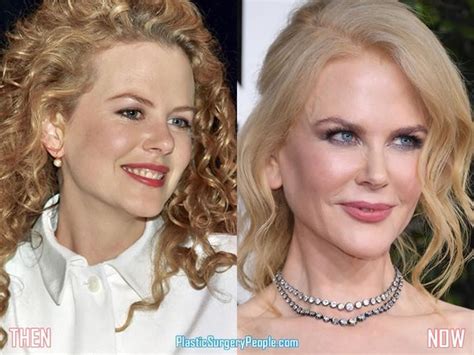 Nicole Kidman Before And After Telegraph