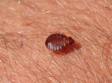 How Long Do Bed Bug Bites Last And How To Make Them Go Away