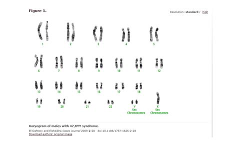 Xyy Chromosome