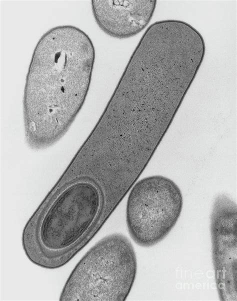 Clostridium Difficile Forming Endospore Photograph By Dr Kari Lounatmaa