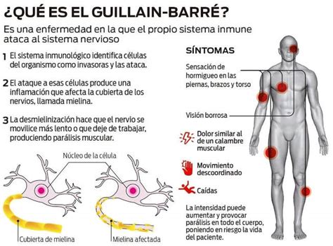 Nerve and damaged myelin sheath. El síndrome de Guillain-Barré: Cuando tu peor enemigo eres ...