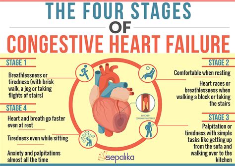 Congestive Heart Failure Chf Symptoms Stages Life Expectancy