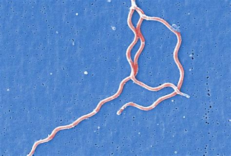 Lyme Discovery Borrelia Bacteria Hides Inside Parasitic Worms Causing