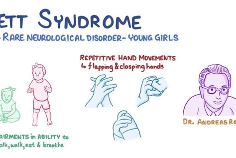 Rett Syndrome Causes Symptoms Stages Treatment Abtc
