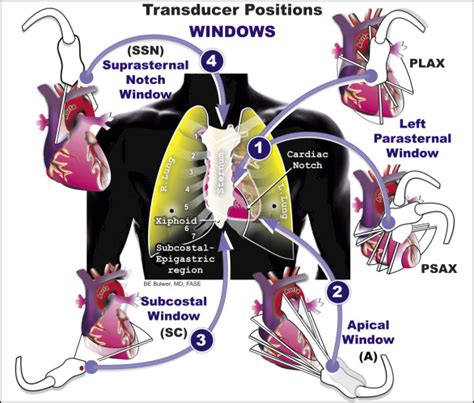 Principles Of Transthoracic Imaging Acquisition The Standard Adult