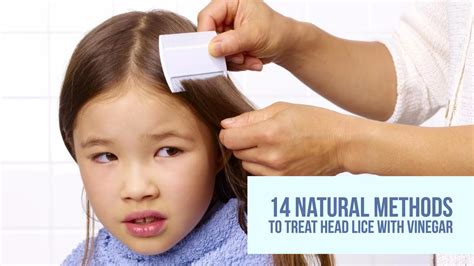 14 Natural Methods To Treat Head Lice With Vinegar Wellnessguide