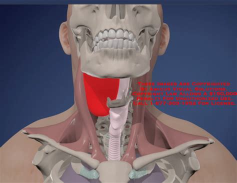 Amicus Illustration Of Amicusanimationneckhematomagrowthintubation