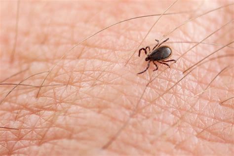What To Do If Youre Bitten By A Tick The Healthy