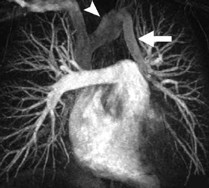 CediMed Resonancia Magnética Cardíaca Casos de Ecocardiografía