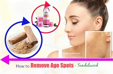 13 Tips How To Remove Age Spots On Face Hands Arms And Legs Naturally
