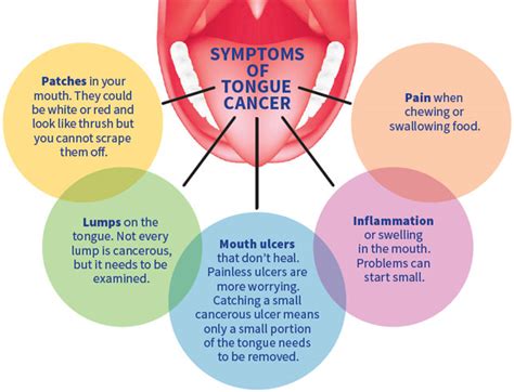 Tongue Cancer Stages Causes Symptoms And Preventions