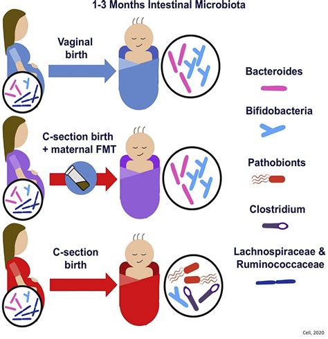 Feeding C Section Newborns With Maternal Fecal Bacteria Restores Gut
