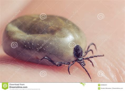 Tick Filled With Blood Sitting On Human Skin Stock Image Image Of
