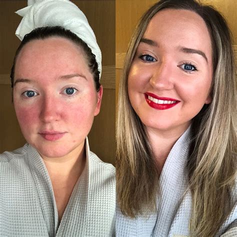 14 Redness Reducing Products I Swear By Since Being Diagnosed With Rosacea