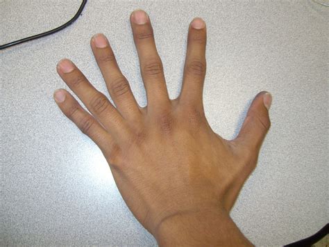 6 Fingers Hand Weird Stuff In The World Pinterest
