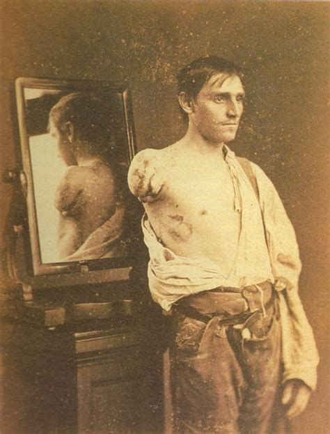 Civil War Portrait Of A Gentleman After Amputation Via Flesh World
