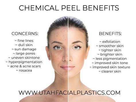 The Benefits Of Chemical Peels Utah Facial Plastics