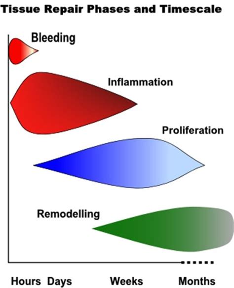 Soft Tissue Repair And Healing Review Injury Rehabilitation Healing Repair