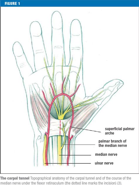 Figure 1 From Carpal And Cubital Tunnel And Other Rarer Nerve
