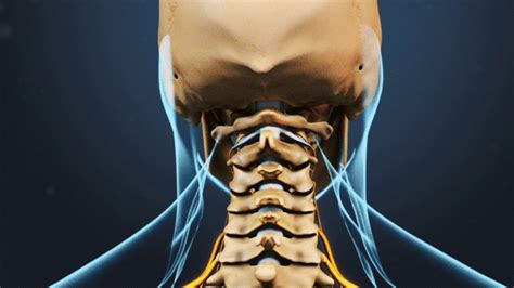 How Cervical Radiculopathy Causes Pain Numbness And Weakness Spine