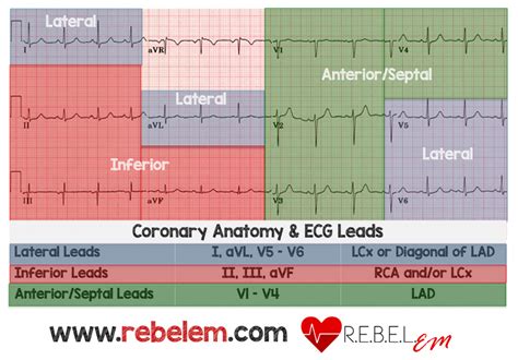 Dr Smiths Ecg Blog April 2018