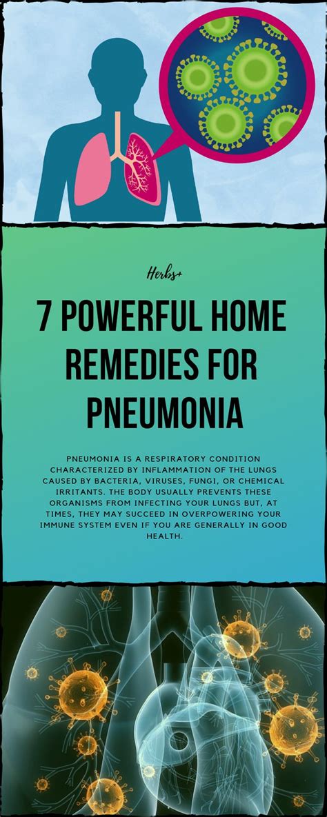 7 Powerful Home Remedies For Pneumonia Pneumonia Remedies Pneumonia