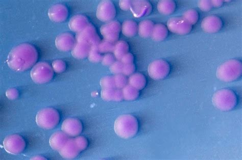 Biochemical Test Of Streptococcus Agalactiae