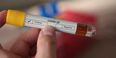 Information on how to register for an sms result is provided when you get tested. Coronavirus: can you get a home test kit for COVID-19? - Which? News