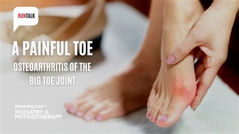 A Painful Toe Osteoarthritis Of The Big Toe Joint Youtube