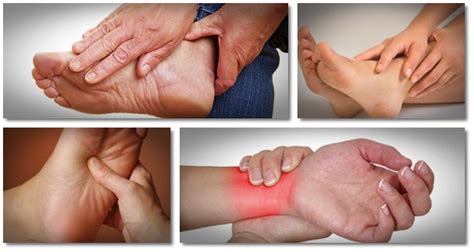 533 likes · 26 talking about this. How To Treat Gout Naturally | How "Cure Gout Now" Helps ...