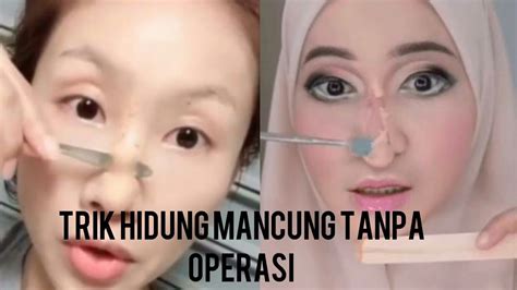 Ilustrasi hidung bule mancung, sedangkan hidung orang indonesia cenderung pesek. Tren hidung mancung menggunakan lilin - YouTube