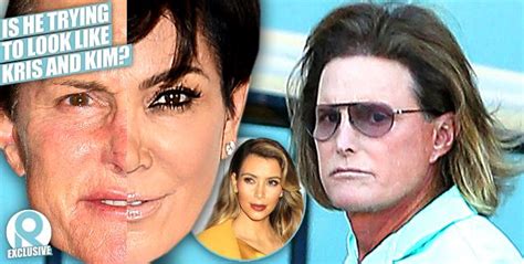 Bruce Jenner S Transformation Continues Star Had Hair Transplant Surgery And Procedures To