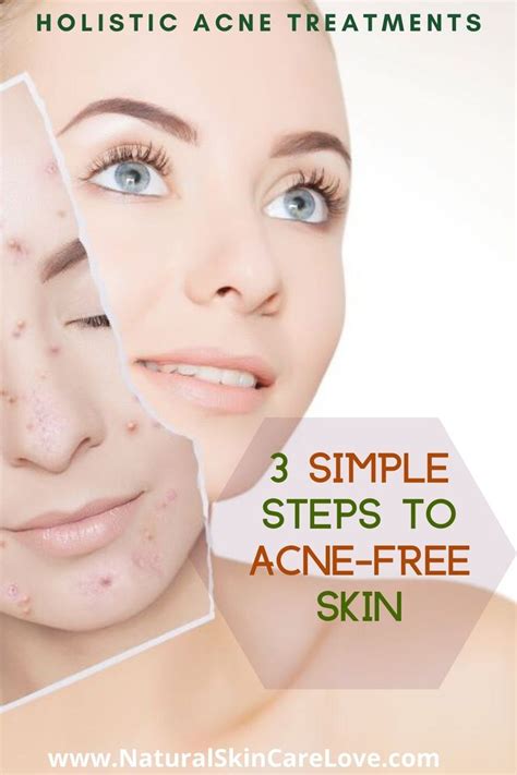 Holistic Acne Treatments 3 Easy Steps For Radiant Skin Holistic