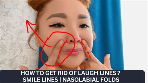 How To Get Rid Of Laugh Lines Smile Lines Nasolabial Folds Youtube