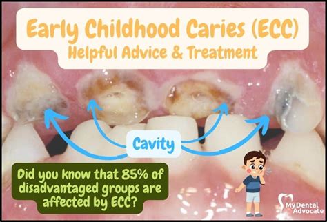 Pediatric Dentistry The Ultimate Guide Content Hub Mda