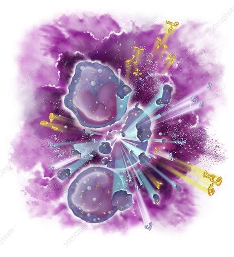 Tumor Lysis Syndrome Illustration Stock Image C0501406 Science