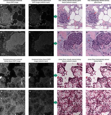 Virtual Staining Results Match The H E And Jones Stained Images Ah