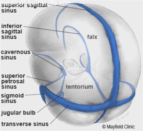 Illustration The Two Major Dural Folds The Falx And Tentorium Along