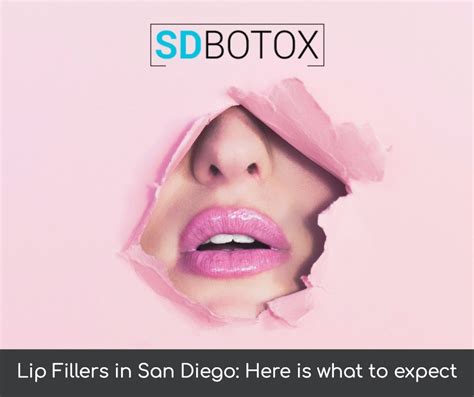 Everything You Need To Know About Lip Fillers In San Diego Sd Botox