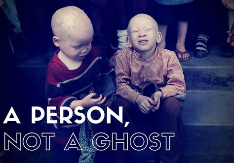 People With Albinism In Africa An At Risk Minority Sisters Are Helping