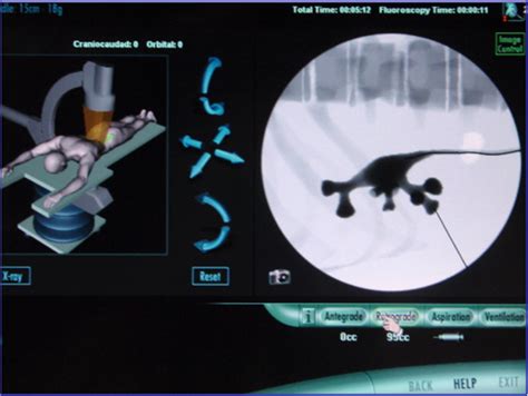 Training In Percutaneous Nephrolithotomy—a Critical Review European