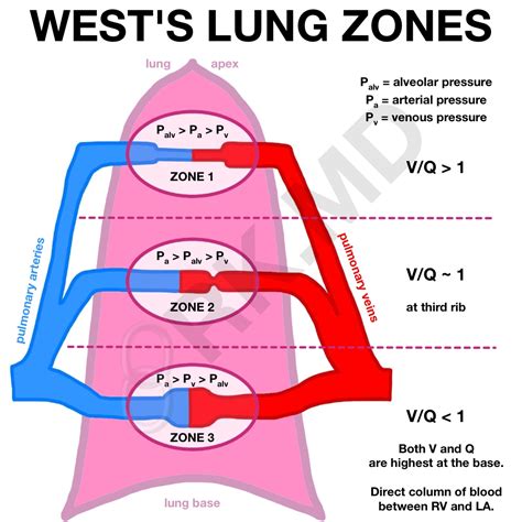 Wests Lung Zones Rkmd