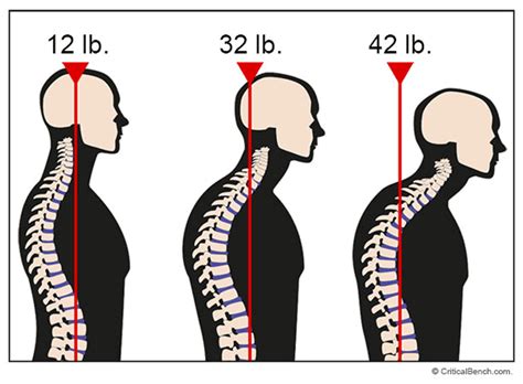 What Is Forward Head Posture And The Benefits Of Correcting Forward