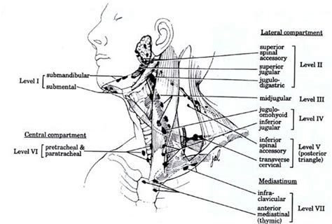 Neck Lymph Node Levels Note Infraclavicular And Mediastinal Is Level