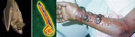 The marburg virus spreads mainly through bodily fluids. Marburg virus - VIRALSITA