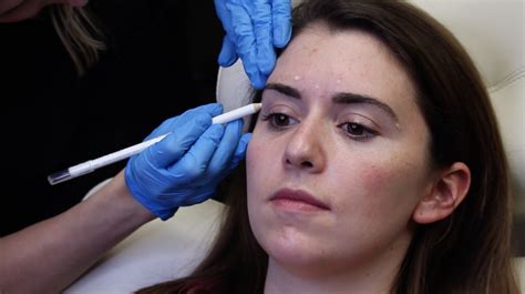4 Things To Expect For First Time Botox Injections Your Wellness Center