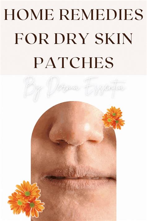 Dry Skin Patches Top Home Remedies To Treat In 2021 Dry Skin Home