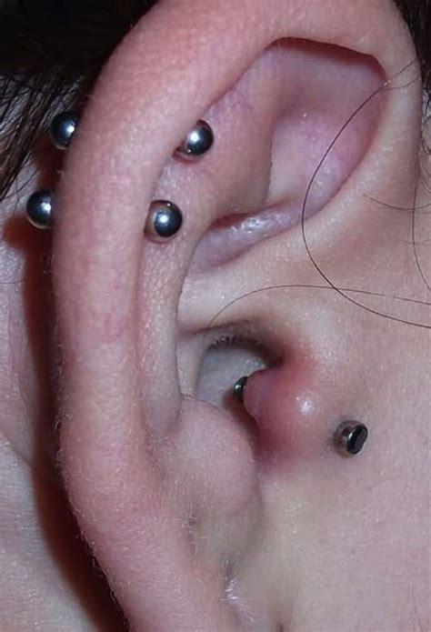 Causes Of Infected Piercings