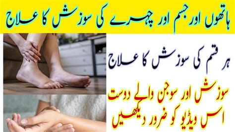 Hathon Pairon Aur Chehre Ki Sujan Ka Ilaj Paon Ki Sojen Feet Swelling Treatment Youtube